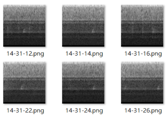 Spectrogram